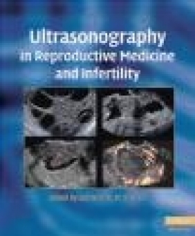 Ultrasonography in Reproductive Medicine and Infertility B Rizk
