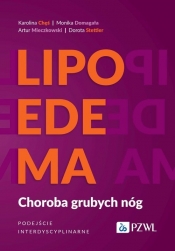 Lipoedema - Chęś Karolina, Domagała Monika, Mieczkowski Artur, Stettler Dorota