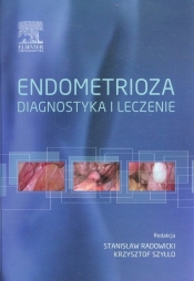 Endometrioza diagnostyka i leczenie - <br />