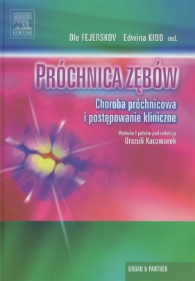 Próchnica zębów - <br />