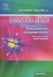 Próchnica zębów - <br />