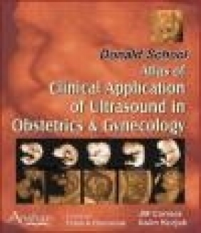 Atlas of Clinical Application of Ultrasound in Obs Asim Kurjak, J. M. Carrera,  Kurjak