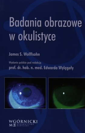 Badania obrazowe w okulistyce - James S. Wolffsohn