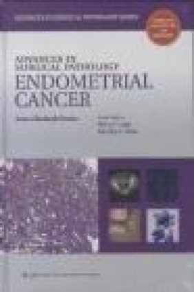 Advances in Surgical Pathology Endometrial Carcinoma Anna Sienko, A Sienko