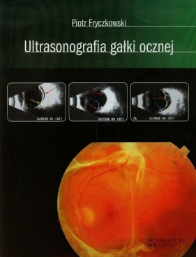 Ultrasonografia gałki ocznej - Fryczkowski Piotr