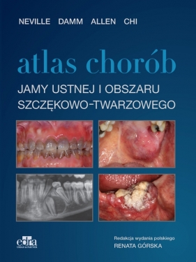 Atlas chorób jamy ustnej i obszaru szczękowo-twarzowego - Damm N., Chi A.