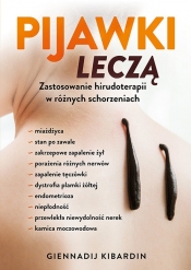 Pijawki leczą - Giennadij Kibardin