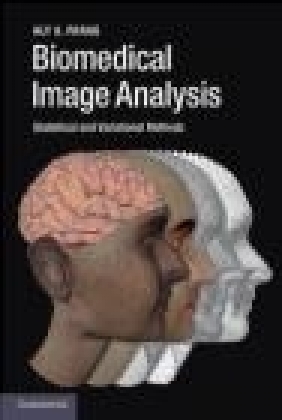Biomedical Image Analysis Aly Farag