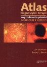 Atlas diagnostyki i terapii zwyrodnienia plamki związanego z wiekiem Kucharczuk Jan, Sikorski Bartosz Ł.