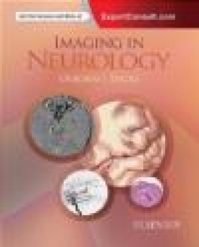 Imaging in Neurology Kathleen Digre, Anne Osborn