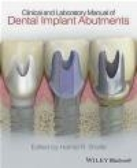 Clinical and Laboratory Manual of Dental Implant Abutments Hamid Shafie