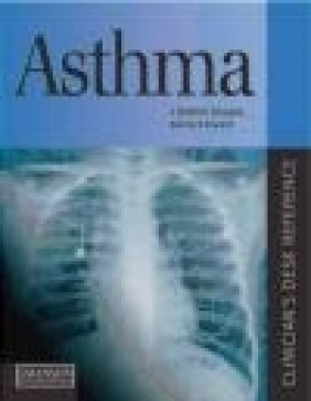 Asthma Kurtis S. Elward, J. Graham Douglas