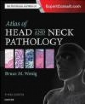 Atlas of Head and Neck Pathology Bruce Wenig