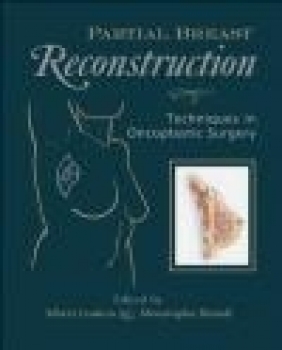 Partial Breast Reconstruction A Losken