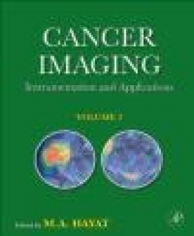 Cancer Imaging v 2 M. Hayat,  Hayat