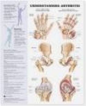 Understanding Arthritis Anatomical Chart