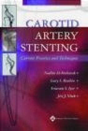 Carotid Artery Stenting Current Practice N Al-Mubarak