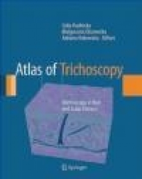 Atlas of Trichoscopy