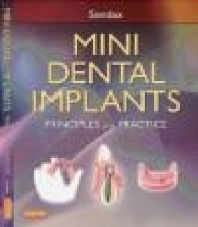 Mini Dental Implants Victor Sendax