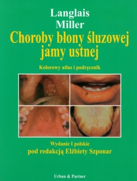 Choroby błony śluzowej jamy ustnej - Langlais Robert P., Miller Craig S.<br />