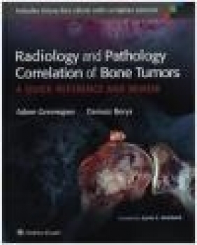 Radiology and Pathology Correlation of Bone Tumors Dariusz Borys, Adam Greenspan