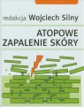 Atopowe zapalenie skóry