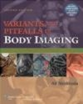 Variants and Pitfalls Body Imaging Ali Shirkhoda,  Shirkhoda