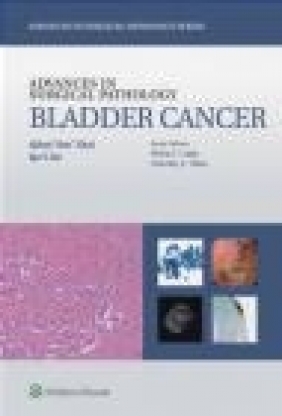 Advances in Surgical Pathology: Bladder Cancer Jae Ro, Qihui , &, quot;Jim, &, quot; Zhai