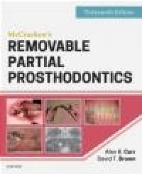 Mccracken's Removable Partial Prosthodontics 13e David Brown, Alan Carr
