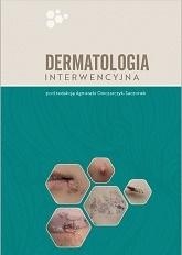 Dermatologia interwencyjna