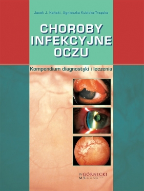 Choroby infekcyjne oczu - Jacek J. Kański, Agnieszka Kubicka-Trząska