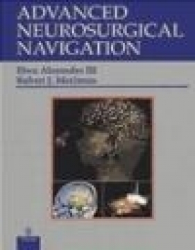 Advanced Neurosurgical Navigation - Eben Alexander