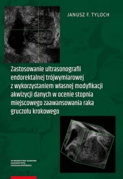 Zastosowanie ultrasonografii endorektalnej trójwymiarowej