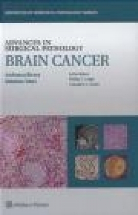 Advances in Surgical Pathology: Brain Cancer