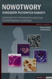 Nowotwory narządów płciowych kobiety
