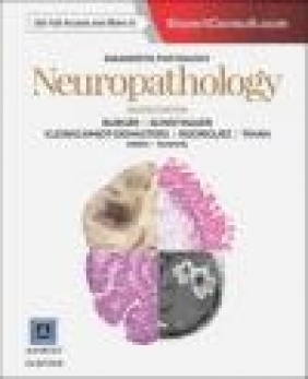 Diagnostic Pathology: Neuropathology Fausto Rodriguez, Tarik Tihan, Bette Kleinschmidt-Demasters