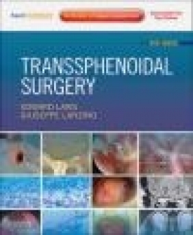 Transsphenoidal Surgery Edward R. Laws, Giuseppe Lanzino, E Laws