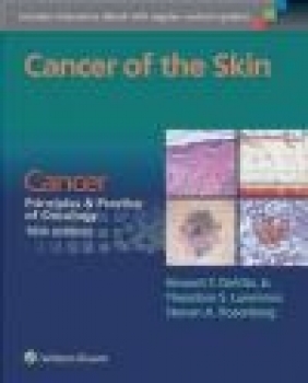 Cancer of the Skin Steven Rosenberg, Theodore Lawrence, Vincent DeVita