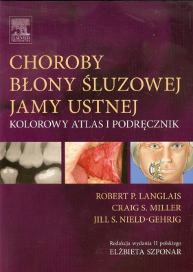 Choroby błony śluzowej jamy ustnej - Craig S. Miller, Jill S. Nield-Gehrig, Robert P. Langlais