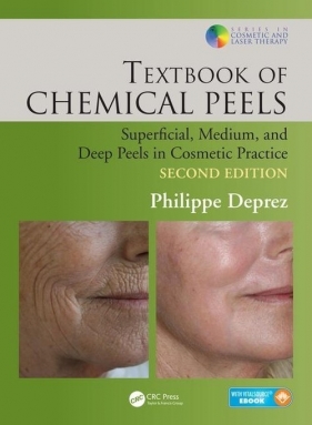 Textbook of Chemical Peels - Deprez Philippe