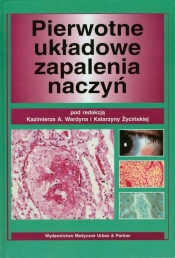 Pierwotne układowe zapalenia naczyń