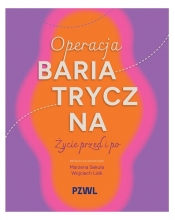 Operacja bariatryczna. Życie przed i po - Wojciech Lisik