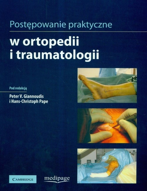 Postępowanie praktyczne w ortopedii i traumatologii