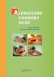Alergiczne choroby oczu - Bogacka Ewa, Czajkowski Janusz, Małolepszy Józef