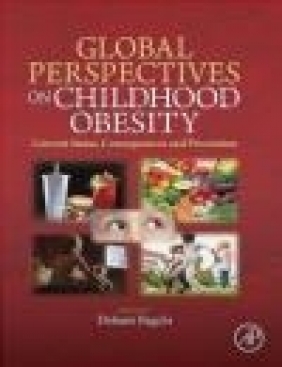 Global Perspectives on Childhood Obesity Debasis Bagchi