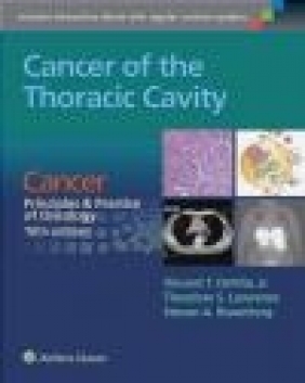 Cancer of the Thoracic Cavity Steven Rosenberg, Theodore Lawrence, Vincent DeVita