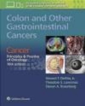 Colon and Other Gastrointestinal Cancers