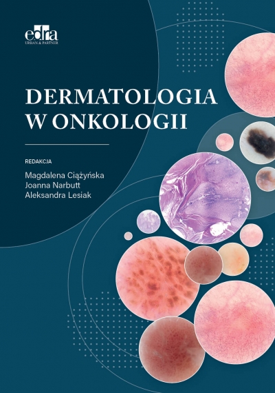 <img src='https://webimage.pl/pics/964/7/d9788368527964.jpg' style='height:440px' /> Dermatologia w onkologii
