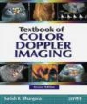 Textbook of Colour Doppler Imaging 2e Satish K. Bhargava, S Bhargava