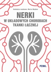 Nerki w układowych chorobach tkanki łącznej - Maria Majdan .